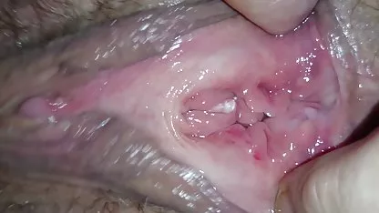 موهای متوقف می شود شده و انجمن kir2kos سپس معروف لگد کردن